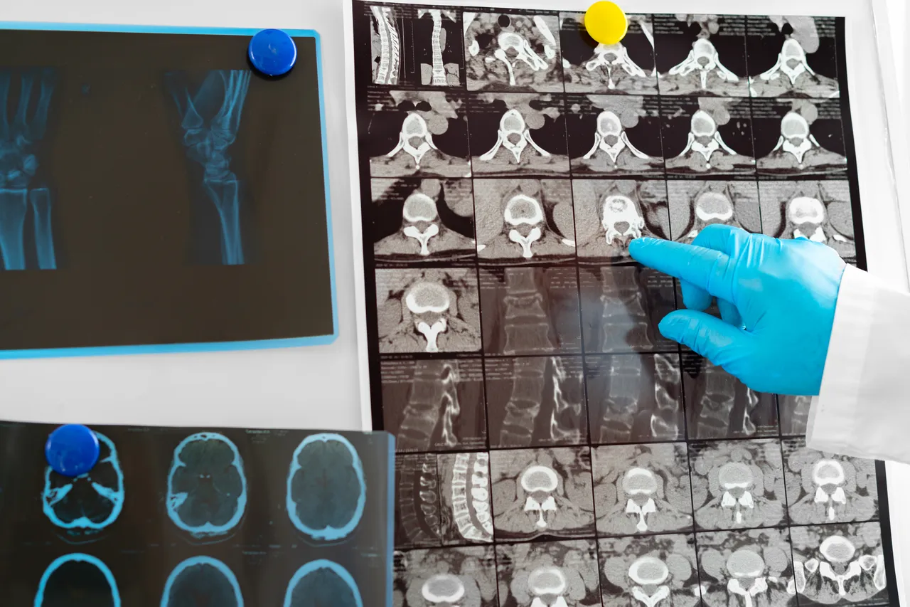 Non limitarti alla solita prevenzione: ecco gli screening gratuiti che puoi fare subito e ti salvano la vita